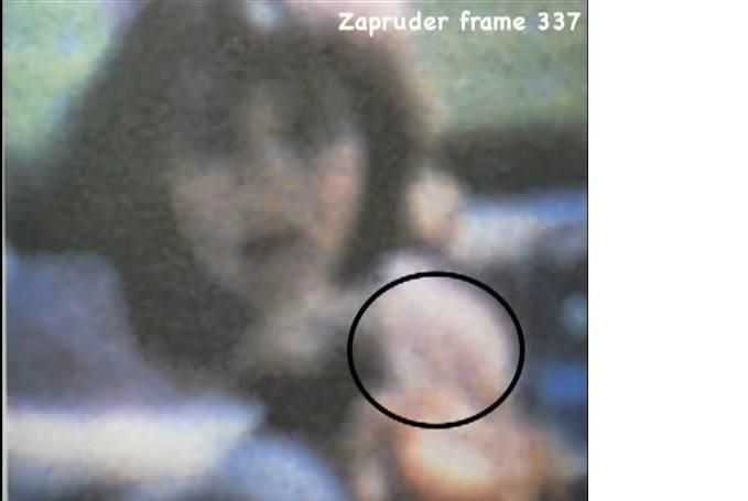photo Holeinbackofhead_zpsdda1d29e.jpg